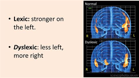 Different Brains • Evidence Based Teachers Network