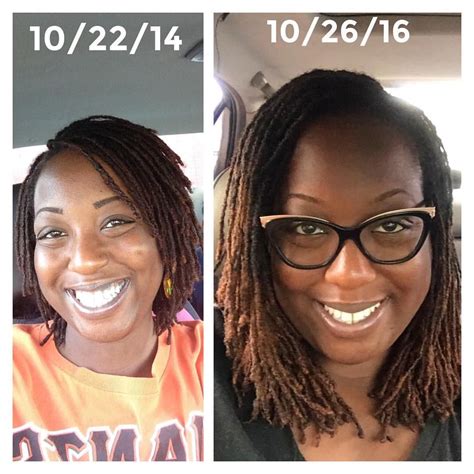 2 years later, 2 years older, 2 years wiser, 20 pounds heavier ?. 2 years into my loc journey 