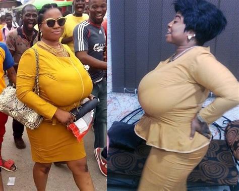 See New Photos Of The Gigantic Chested Lady That Caused Commotion At