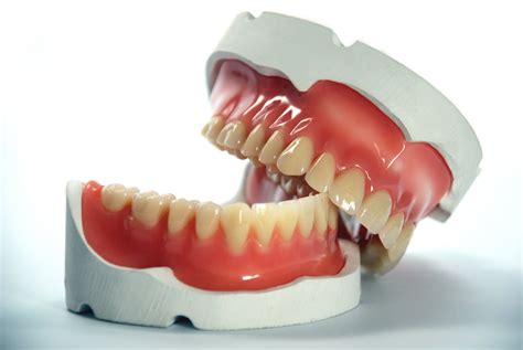 Quais São Os Benefícios Da Prótese Dentária Odontolatina