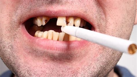 what are the long term effects of tobacco products on your dental health news dentagama