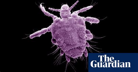 Are Pubic Lice In Danger Of Extinction Sexual Health The Guardian