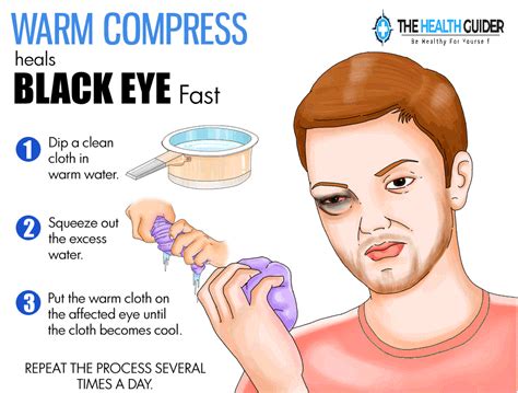 Warm Compress Heals Black Eye Fast Eye Black Black Eye Remedies