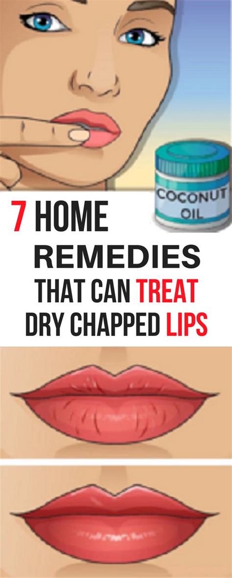 7 Home Remedies That Can Treat Dry Chapped Lips Health Diy Blog