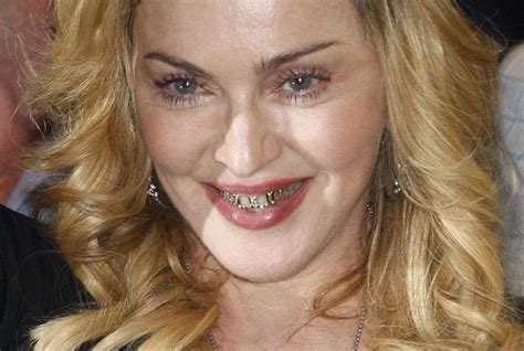 Mad News Hollywood Celebrities With Really Bad Teeth