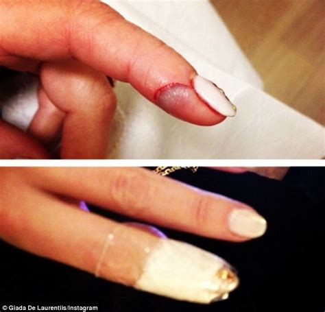 Posted on wed, 19 dec 2012. Ouch! Celebrity chef Giada De Laurentiis slices her finger ...