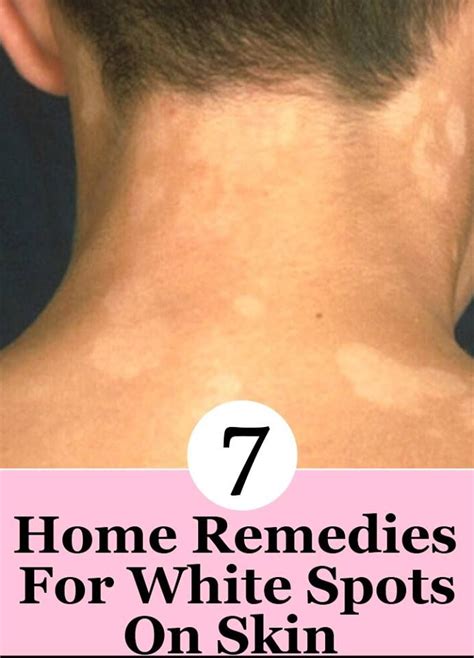 154 Best Images About Skin Care On Pinterest Oily Skin Skin Care And