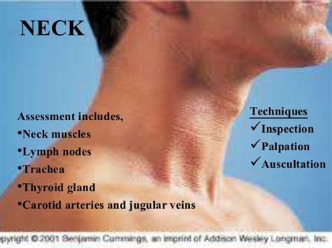 Physical Examination Head And Neck