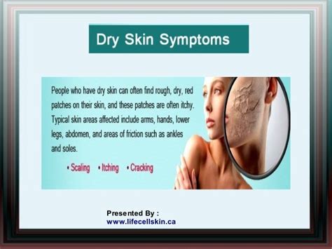 Dry Skin Facts And Remedies