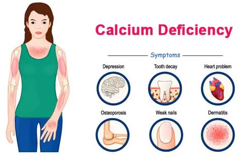 Hidden 7 Symptoms Of Calcium Deficiency In Adults