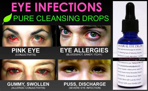 Natural Eye Drops For Pink Eye And Eye Infections Pure Cleansing Drops