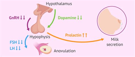 what is hyperprolactinemia causes symptoms and treatments