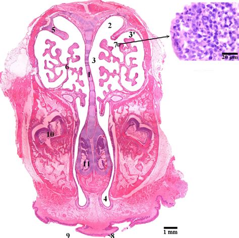 Figure 6 From Nalt Nasal Cavity Associated Lymphoid Tissue In The