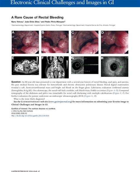 A Rare Cause Of Rectal Bleeding Gastroenterology