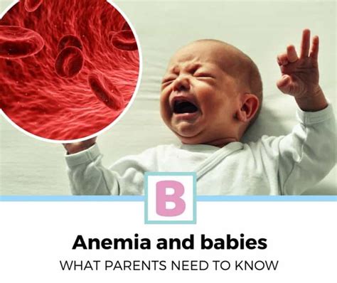 What Is Anemia For Babies What Parents Should Know Baby Schooling