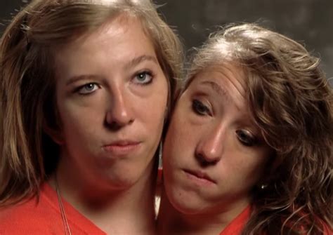 Everything To Know About Famous Conjoined Twins Abby And Brittany