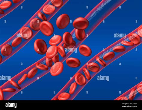Burst Blood Vessel Computer Artwork Of Red Blood Cells Bursting Out Of