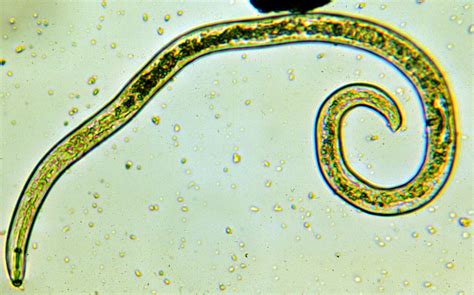 Nematoda Roundworms Nemata Nematodes Discover Life