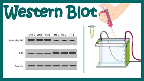 Western Blot Western Blotting Protocol Application Of Western Blot