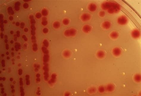 Serratia Marcescens Antibiotics