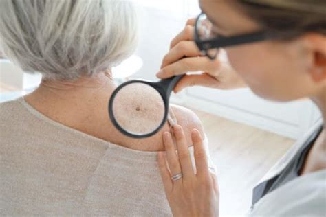 Whats The Difference Between Actinic Keratosis And Seborrheic