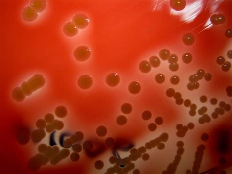 Staphylococcus Lugdunensis 48 Hours Incubation Tsa 5 Blo Flickr