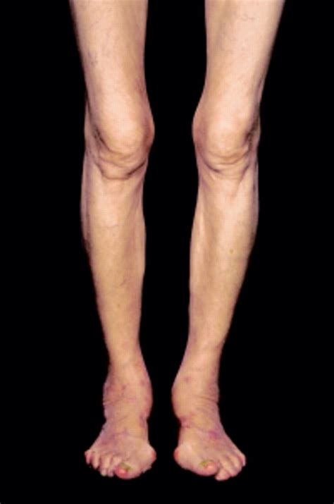 Male Muscle Anatomy Serratus