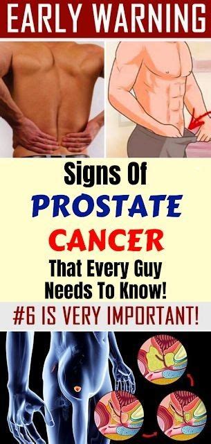 12 Early Warning Signs Of Prostate Cancer That Every Guy Needs To Know Healthy Lifestyle
