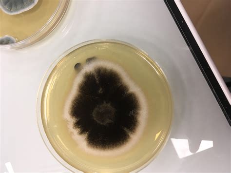 What Is This Fungi Aspergillus Rmicrobiology