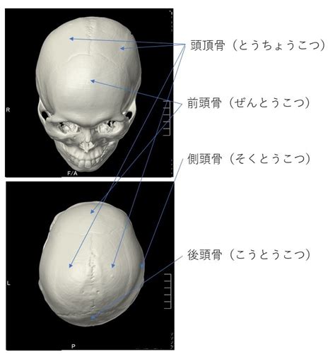 画像診断（頭蓋骨） 名古屋～春日井の脳神経外科 勝川脳神経クリニック