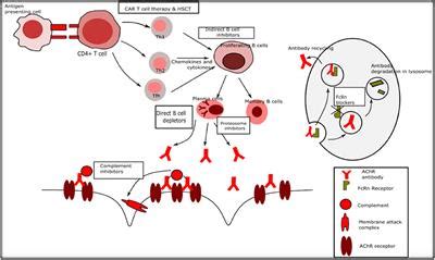 However, available treatments usually can control symptoms, allowing those diagnosed with the. Remdesivir In Myasthaenia Gravis - Prostigmin In The Diagnosis Of Myasthenia Gravis Nejm : We ...