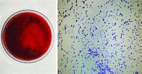 Small Grey Non Haemolytic Colonies Of Enterococcus Avium Were