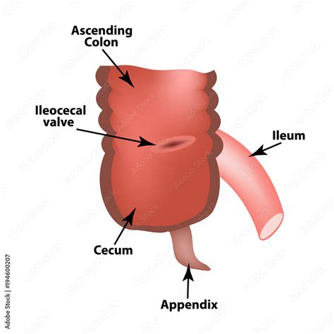 Ileocecal Angle Ileocecal Valve Bauginiev S Damper The Ileum The