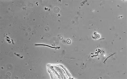 Cavity Saliva Oral Bacteria Microscopy Nature Bacterie