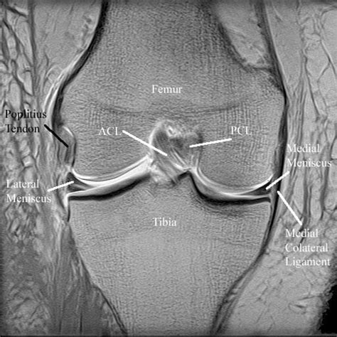 magnetic resonance imaging mri specialist knee surgeon in manchester professor sanjiv jari
