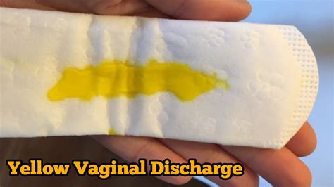 What Causes Vaginal Discharge Normal Abnormal And Colors Of Vaginal