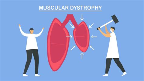 Muscular Dystrophy Is Diseases 1229080 Vector Art At Vecteezy