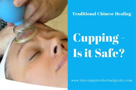 Cupping Therapy Is It Safe Cupping Therapy Traditional Chinese Medicine Holistic Healing