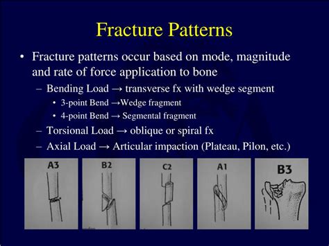 Ppt Basic Principles And Techniques Of Internal Fixation