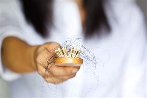 Serious Diseases That Cause Severe Hair Loss Indulging Health