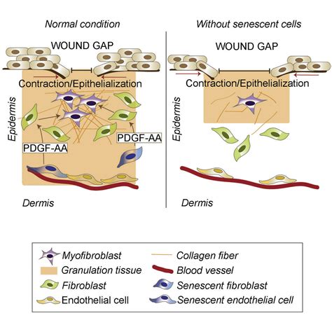 An Essential Role For Senescent Cells In Optimal Wound Healing Through