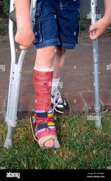 This Young Mans Colorful Leg Cast Has Been Signed By All His New Stock