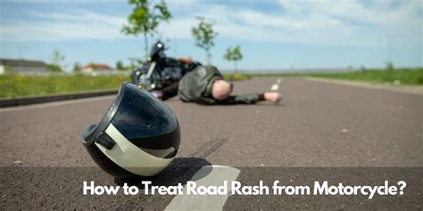 How To Treat Road Rash From Motorcycle Rev Corner