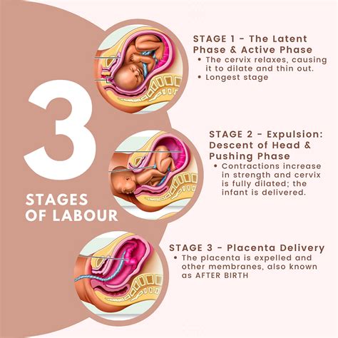 The Three Stages Of Labour