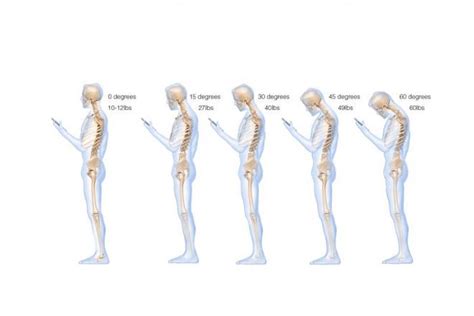 Toca Text Neck Is Smartphone Use Causing Your Neck Pain