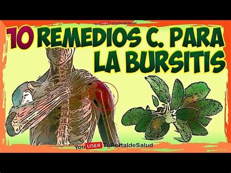 Como siempre, la intervención de un profesional es necesaria para que revise tu caso y pueda darte un tratamiento adecuado. 10 Remedios Caseros para la Bursitis - Bursitis Síntomas y ...