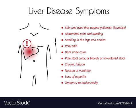 Liver Disease Symptoms Infographic Young Vector Image