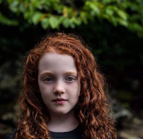 Why Are There So Many Redheads In Ireland Ireland Chauffeur Travel