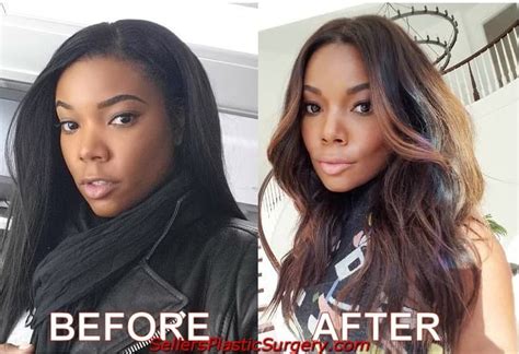 Gabrielle Union Plastic Surgery Before And After