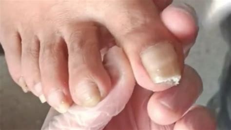 Amazing Stubborn Thick Nail Pedicure No1 Manicure Youtube